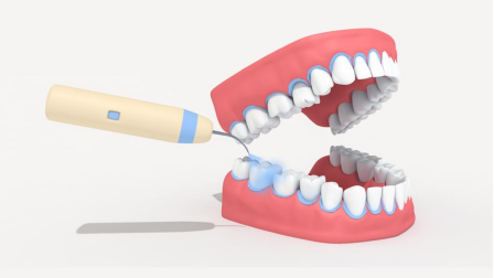 洁牙机频率怎么调超声波洁牙之后，牙缝会更大？_https://www.jmylbn.com_新闻资讯_第1张