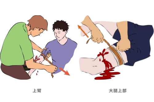 医用绷带为什么能止血抽血时绑胳膊的橡皮管，是什么？_https://www.jmylbn.com_新闻资讯_第6张